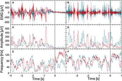 Coupling Between Leg Muscle Activation and EEG During Normal Walking, Intentional Stops, and Freezing of Gait in Parkinson's Disease